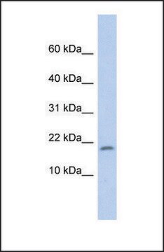 Anti-RPS15 antibody produced in rabbit affinity isolated antibody