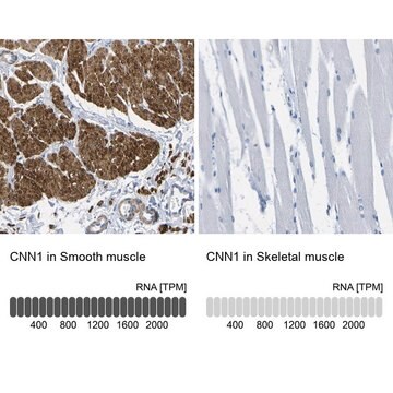 抗CNN1抗体 ウサギ宿主抗体 Prestige Antibodies&#174; Powered by Atlas Antibodies, affinity isolated antibody, buffered aqueous glycerol solution