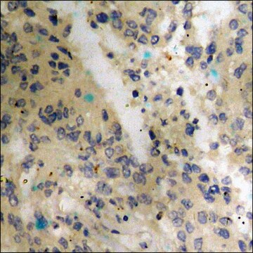 Anti-phospho-p53 (pThr18) antibody produced in rabbit affinity isolated antibody