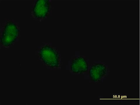 Anti-LMCD1 antibody produced in mouse purified immunoglobulin, buffered aqueous solution