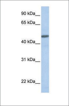 抗CALCRL抗体 ウサギ宿主抗体 affinity isolated antibody