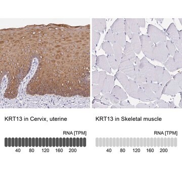 抗KRT13 ウサギ宿主抗体 Prestige Antibodies&#174; Powered by Atlas Antibodies, affinity isolated antibody, buffered aqueous glycerol solution