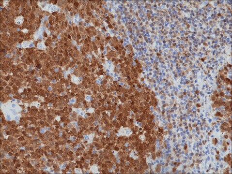 Anti-BOB-1/OBF-1 antibody, Rabbit monoclonal recombinant, expressed in HEK 293 cells, clone RM378, purified immunoglobulin