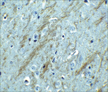 Anti-BACE antibody produced in rabbit IgG fraction of antiserum, buffered aqueous solution