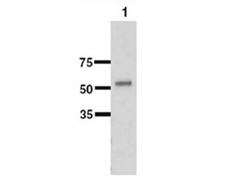 Anti-UGT1a1 Antibody serum, Chemicon&#174;