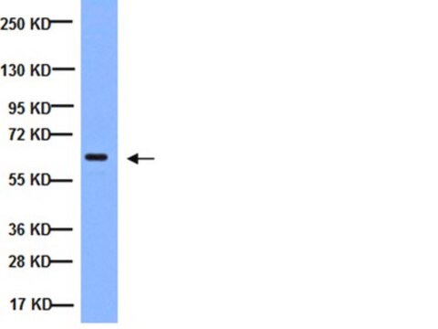 Anticorpo anti-NF&#954;B, subunità p65, subunità attiva, clone 12H11 clone 12H11, Chemicon&#174;, from mouse