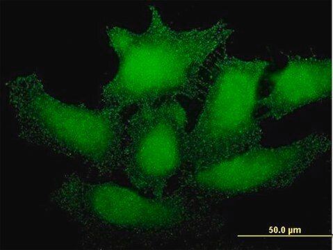 Monoclonal Anti-SMG1 antibody produced in mouse clone 1G5, purified immunoglobulin, buffered aqueous solution