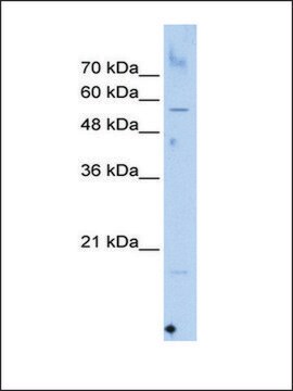 Anti-SEPN1 antibody produced in rabbit affinity isolated antibody