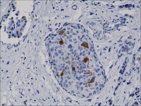 Anti-Cyclin B1 antibody, Rabbit monoclonal recombinant, expressed in HEK 293 cells, clone RM281, purified immunoglobulin