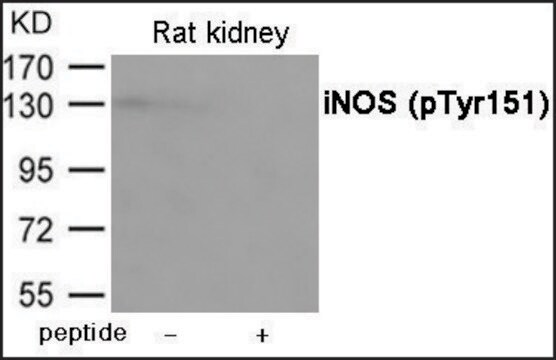 Anty-fosfo-iNOS(pTyr151) affinity isolated antibody