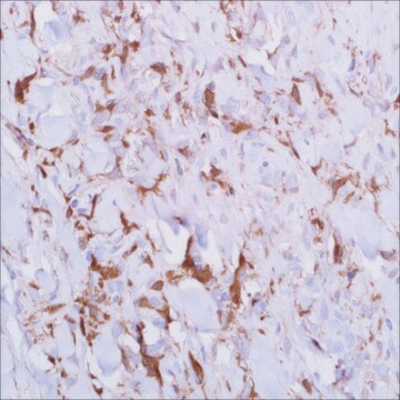 Faktor XIIIa (AC-1A1) Mouse Monoclonal Antibody