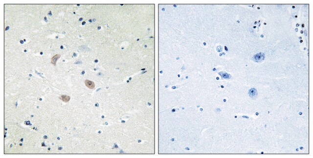 Anti-AKT2 antibody produced in rabbit affinity isolated antibody