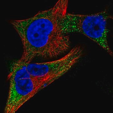 Anti-TYR antibody produced in rabbit Prestige Antibodies&#174; Powered by Atlas Antibodies, affinity isolated antibody