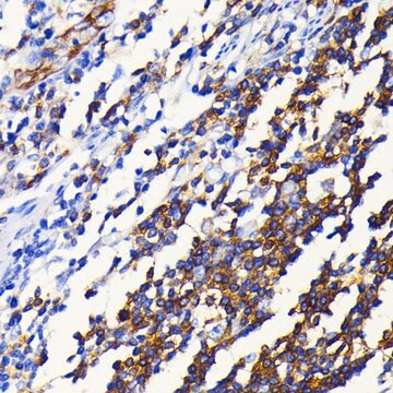 Anti-NF-&#954;B2 Antibody, clone 4K3V3, Rabbit Monoclonal