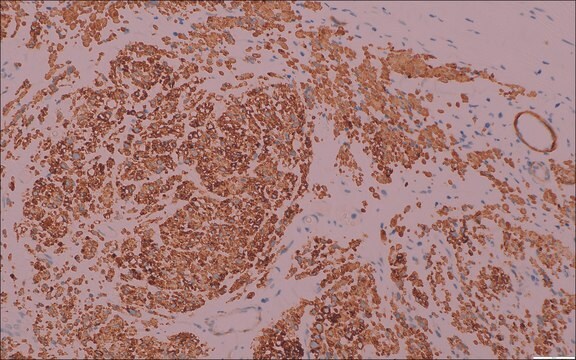 h-Caldesmon (hHCD) Mouse Monoclonal Antibody