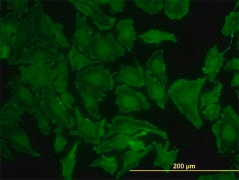 单克隆抗 KRAS 小鼠抗 clone 3B10-2F2, purified immunoglobulin, buffered aqueous solution