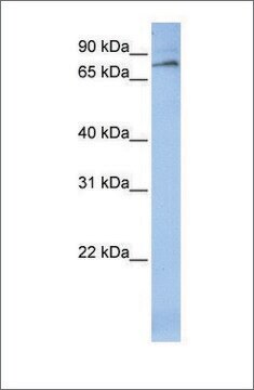 Anti-ALOX12 antibody produced in rabbit affinity isolated antibody