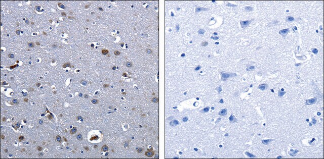 Anti-CBFA1 antibody produced in rabbit affinity isolated antibody