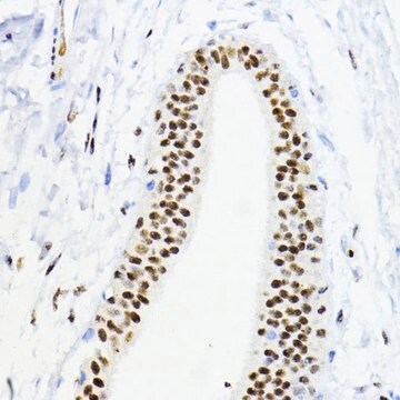 Anti-ZEB1 antibody produced in rabbit