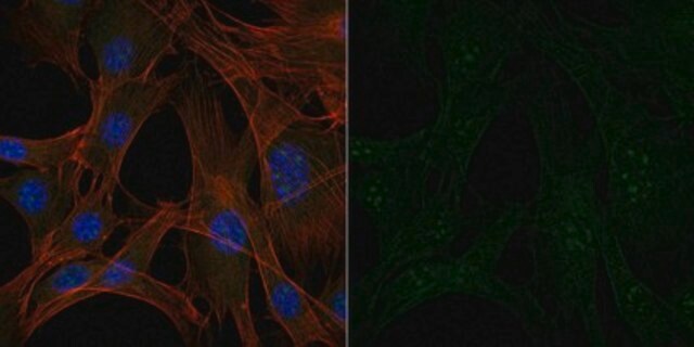 Anti-Interleukin-1&#946; Antibody, Alexa Fluor&#8482; 488 Conjugate from rabbit, ALEXA FLUOR&#8482; 488