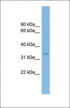 Anti-SSR1 antibody produced in rabbit affinity isolated antibody