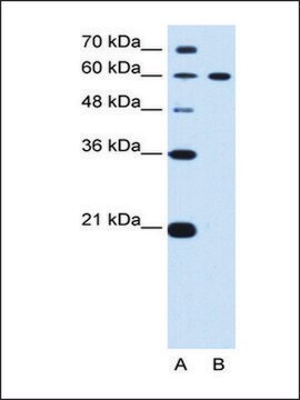 Anti-DTX2 antibody produced in rabbit affinity isolated antibody