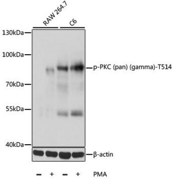 Anti-Phospho-PKC (pan) (gamma)-T514 antibody produced in rabbit