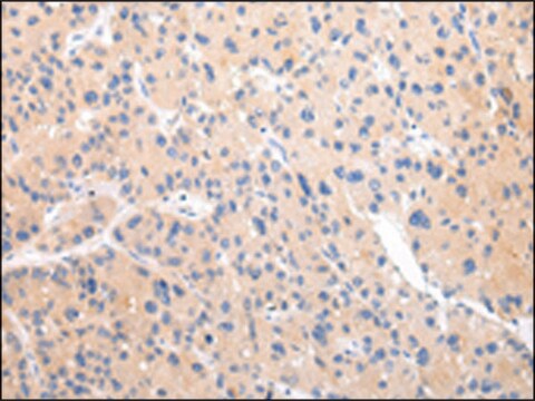 Anti-ZNF106 affinity isolated antibody