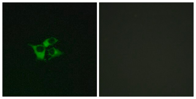 Anti-EDNRA antibody produced in rabbit affinity isolated antibody