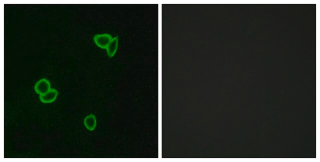 Anti-LPHN1 antibody produced in rabbit affinity isolated antibody