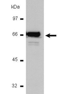 Anti-NF&#954;B p65 Antibody, CT Upstate&#174;, from rabbit