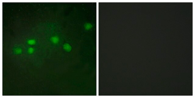 Anti-ELF1 antibody produced in rabbit affinity isolated antibody