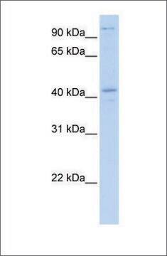 Anti-FGD1 antibody produced in rabbit affinity isolated antibody