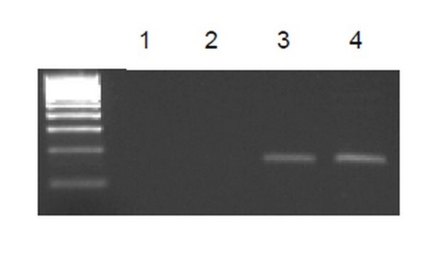 EZ-Magna ChIP&#174; G - Chromatin-Immunpräzipitations-Kit Single day chromatin immunoprecipitation (ChIP) kit containing all necessary reagents to perform 22 individual chromatin immunoprecipitation (ChIP) reactions using magnetic G beads. Control primers included.