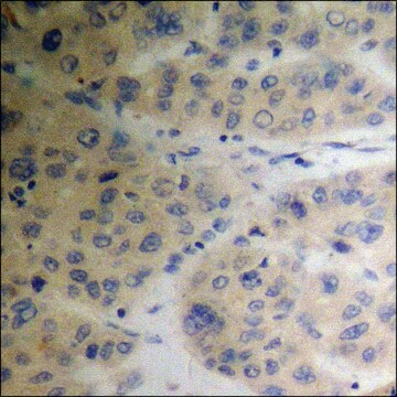 Anti-phospho-TIP60 (pSer86) antibody produced in rabbit affinity isolated antibody