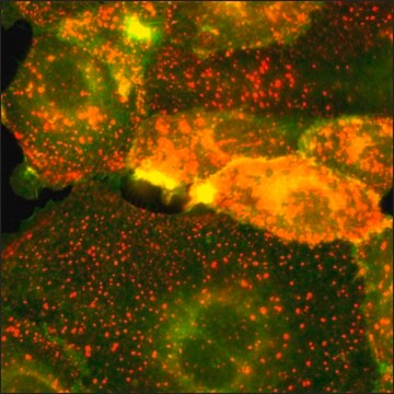 SKOV3細胞GFP-HER2 RFP-EGFR