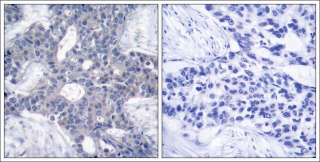 Anti-ZAP70 (Ab-493) antibody produced in rabbit affinity isolated antibody