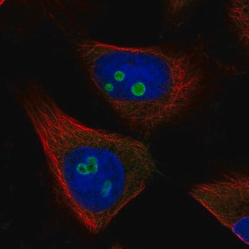 抗-RETSAT 兔抗 Prestige Antibodies&#174; Powered by Atlas Antibodies, affinity isolated antibody