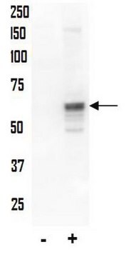 Anti-phospho-AKT (Thr34) Antibody Upstate&#174;, from rabbit