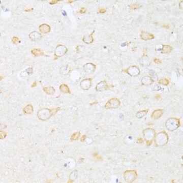 Anti-SQSTM1/p62 antibody produced in rabbit