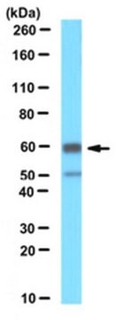 Anti-Pex14 (peroxisomaler Membranmarker) Antikörper serum, from rabbit