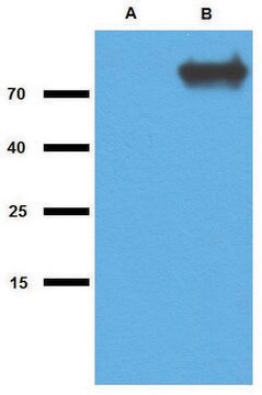 Przeciwciało anty-GlcB(M. tuberculosis) wytwarzane u królika