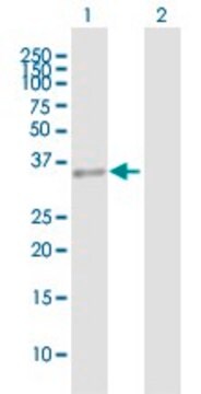 Anti-HLRC1 antibody produced in mouse purified immunoglobulin, buffered aqueous solution