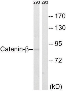 Anti-Catenin-&#946; antibody produced in rabbit affinity isolated antibody