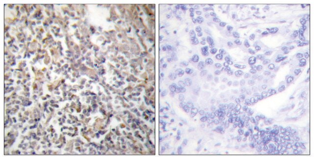 抗-纤连蛋白1 兔抗 affinity isolated antibody