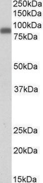 Anti-ZYX antibody produced in goat affinity isolated antibody, buffered aqueous solution