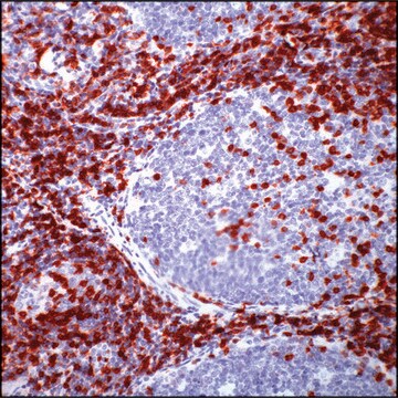 Anti-CD5 antibody, Rabbit monoclonal clone SP19, recombinant, expressed in proprietary host, tissue culture supernatant