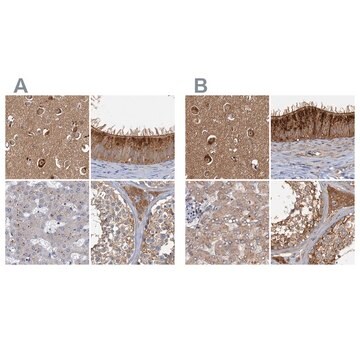 Anti-TOLLIP antibody produced in rabbit Prestige Antibodies&#174; Powered by Atlas Antibodies, affinity isolated antibody, buffered aqueous glycerol solution