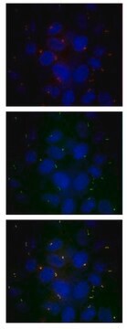 Anti-IFT88 Antibody serum, from rabbit