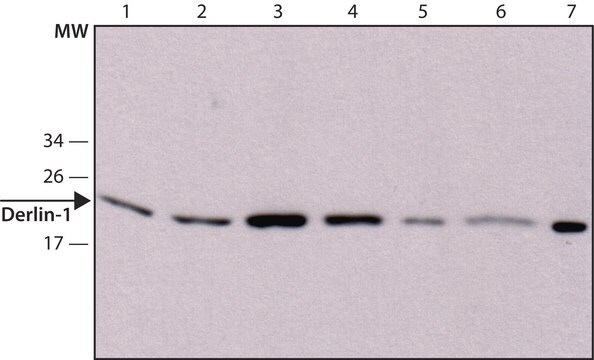 抗デルリン-1抗体、マウスモノクローナル マウス宿主抗体 clone Derlin1-1, purified from hybridoma cell culture